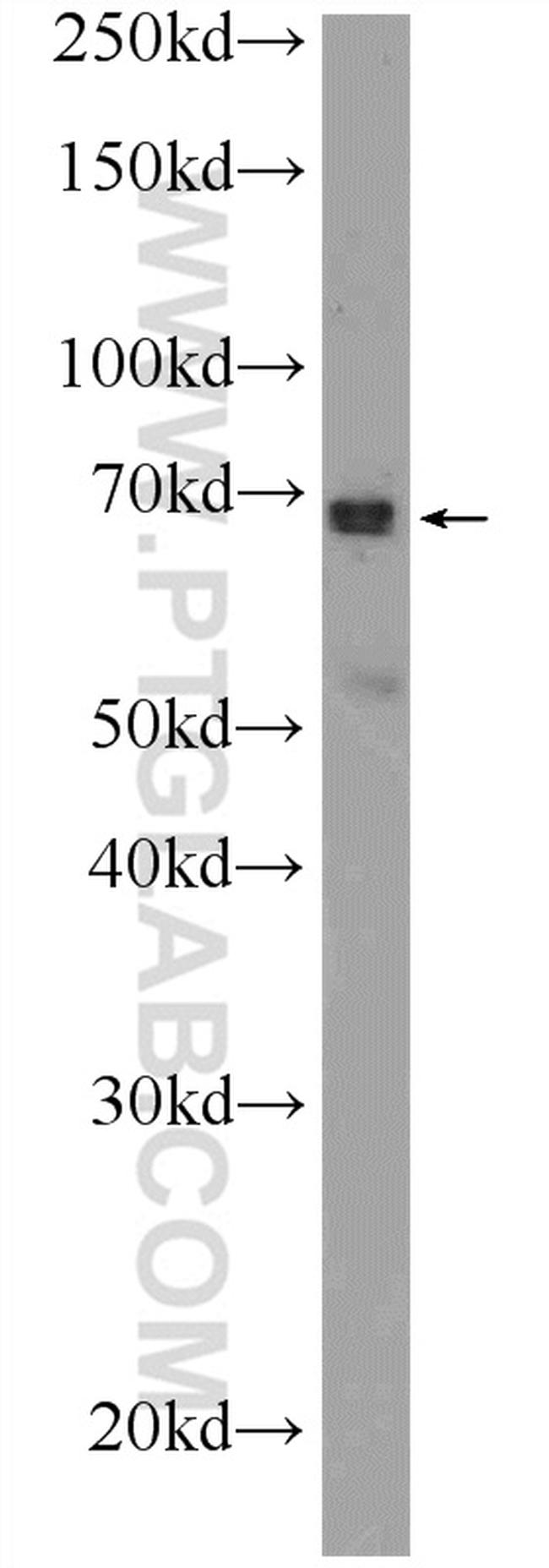 ONECUT2 Antibody in Western Blot (WB)