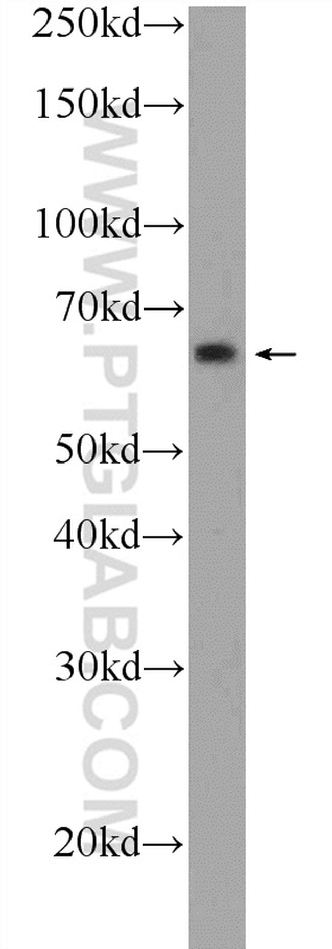 ONECUT2 Antibody in Western Blot (WB)