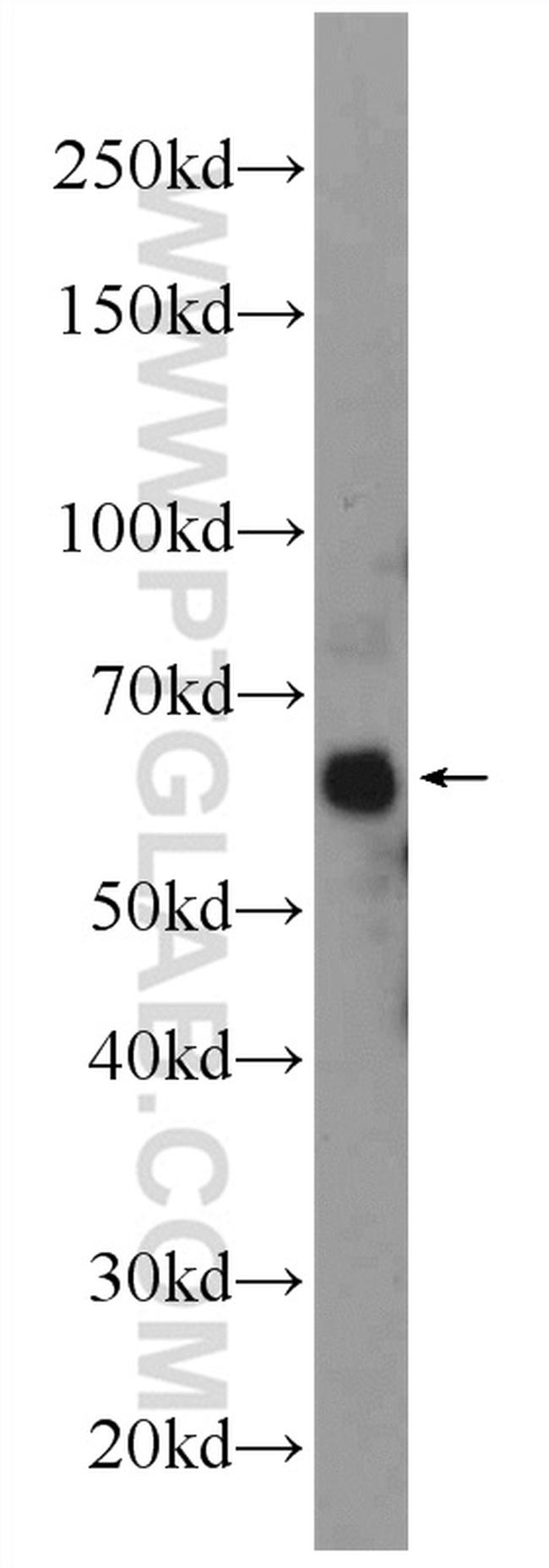 ONECUT2 Antibody in Western Blot (WB)