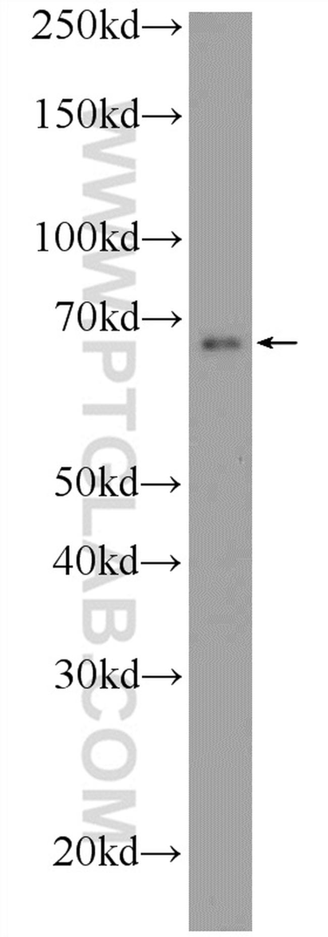 ONECUT2 Antibody in Western Blot (WB)