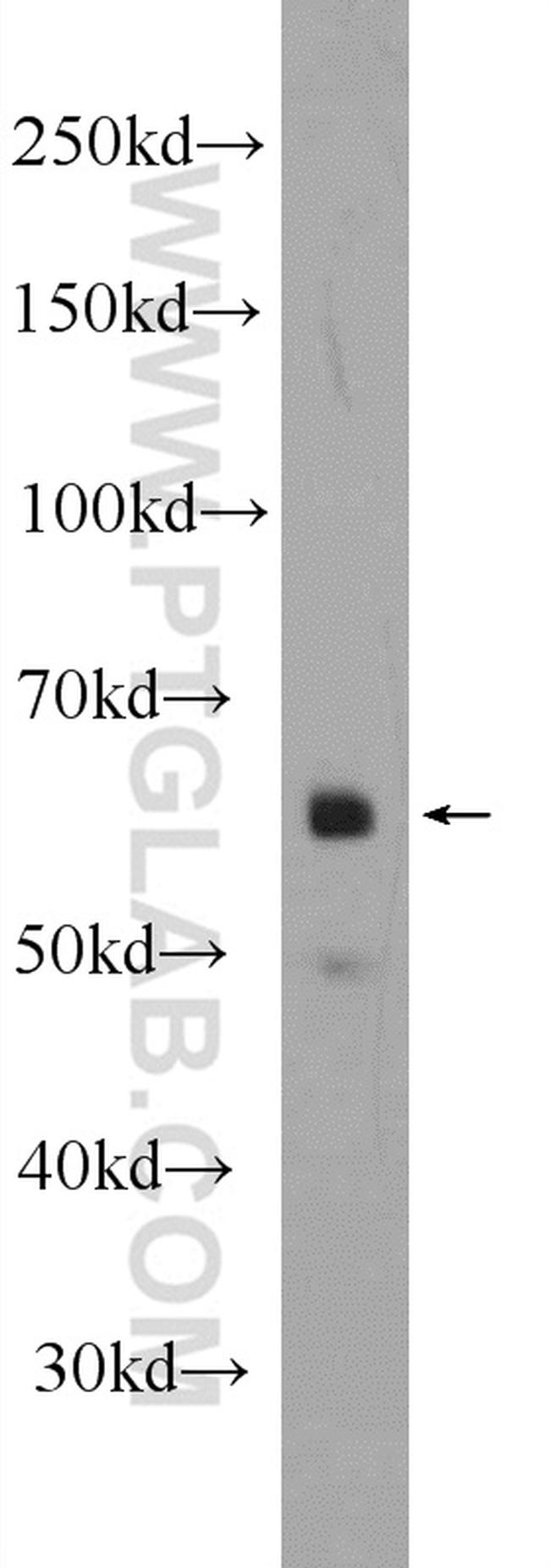 ONECUT2 Antibody in Western Blot (WB)