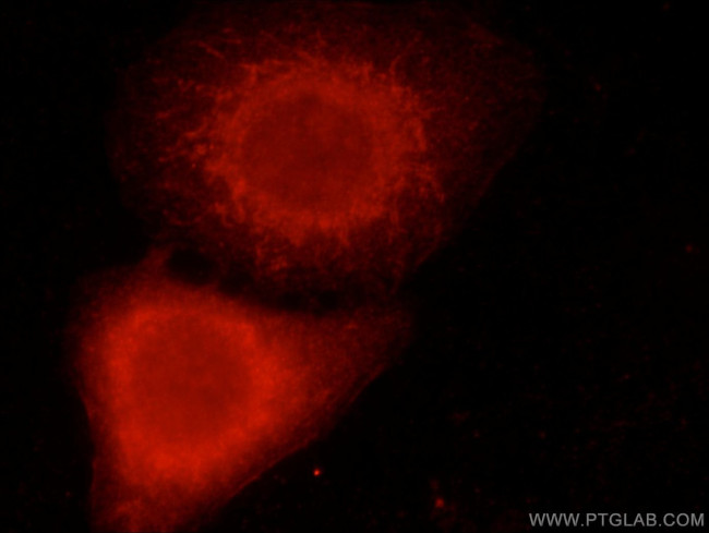 LGI3 Antibody in Immunocytochemistry (ICC/IF)