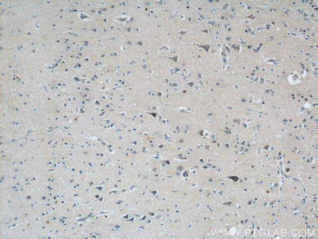 LGI3 Antibody in Immunohistochemistry (Paraffin) (IHC (P))