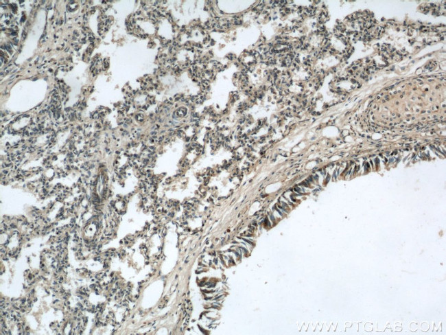 LGI3 Antibody in Immunohistochemistry (Paraffin) (IHC (P))