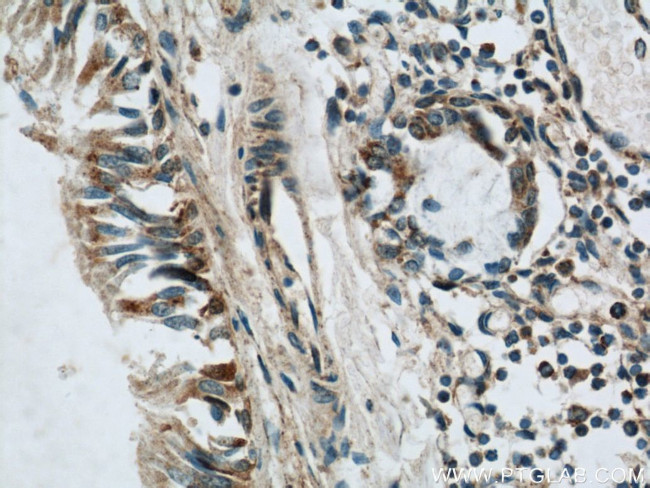 LGI3 Antibody in Immunohistochemistry (Paraffin) (IHC (P))