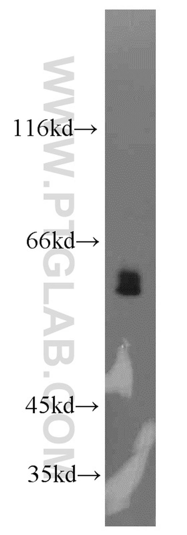 LGI3 Antibody in Western Blot (WB)