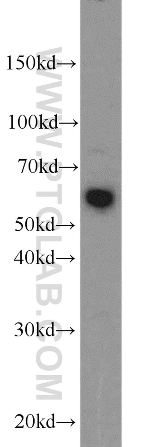 LGI3 Antibody in Western Blot (WB)