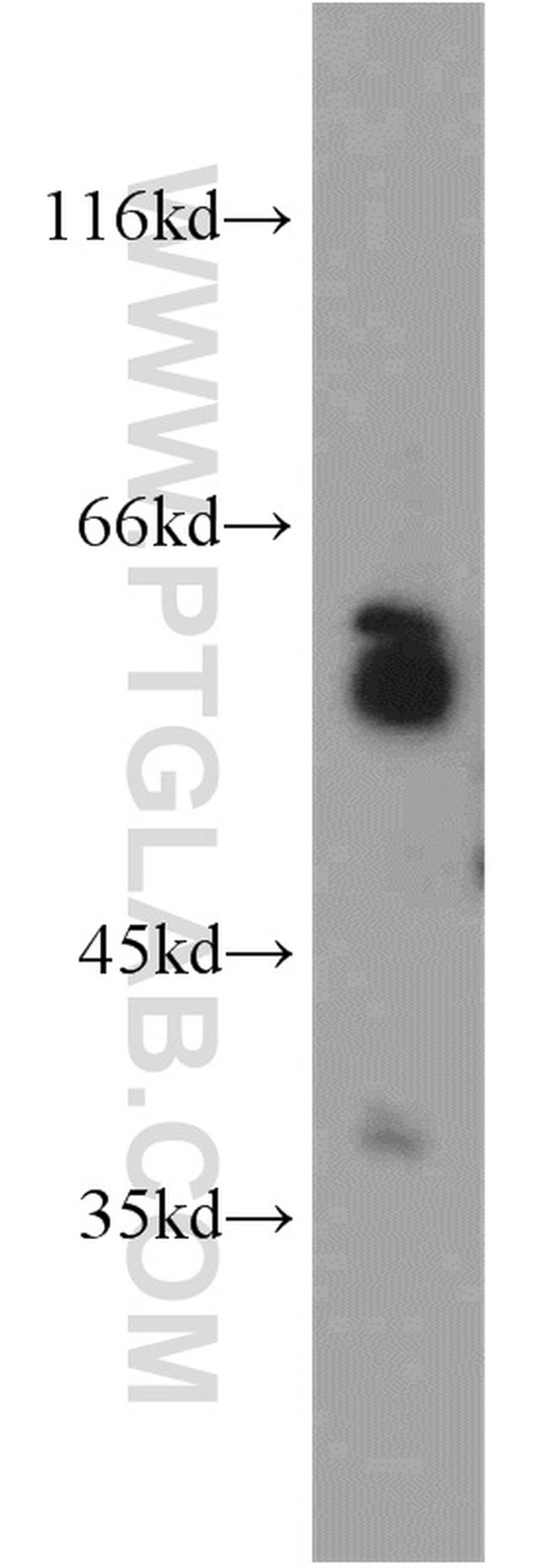 LGI3 Antibody in Western Blot (WB)