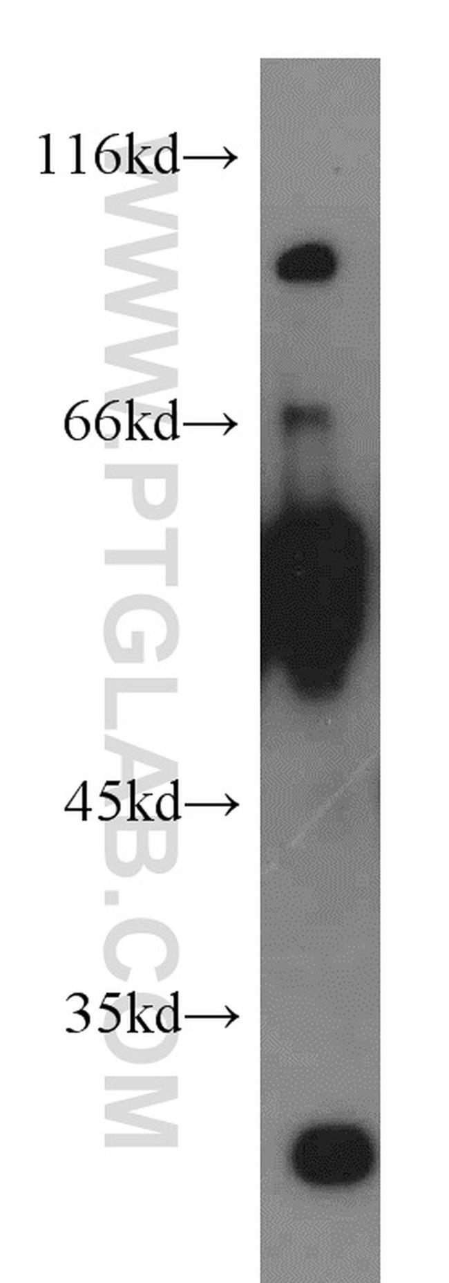 LGI3 Antibody in Western Blot (WB)