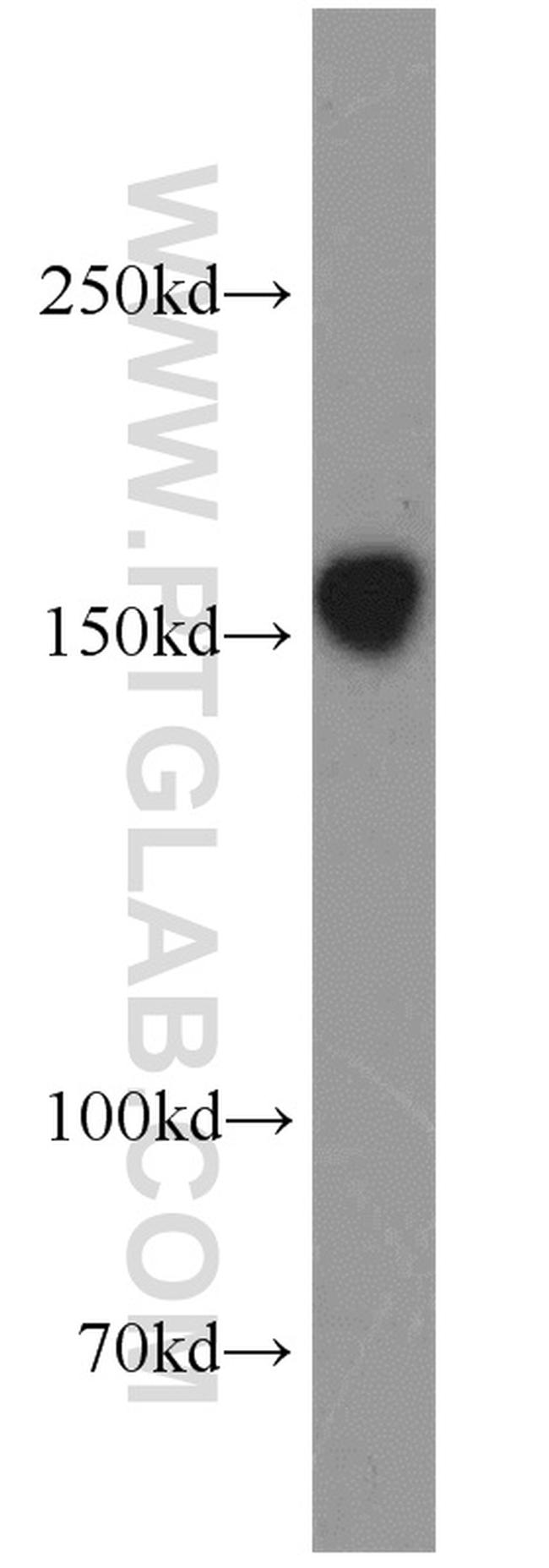 GRIN2B Antibody in Western Blot (WB)
