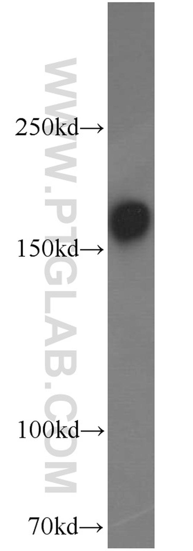 GRIN2B Antibody in Western Blot (WB)