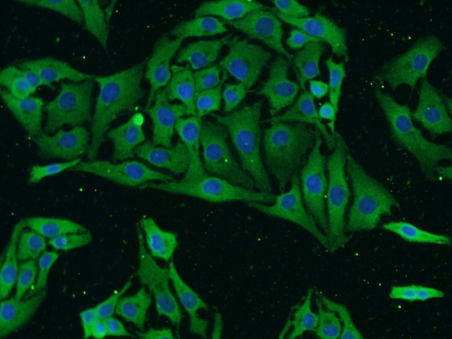 GRIN2B Antibody in Immunocytochemistry (ICC/IF)