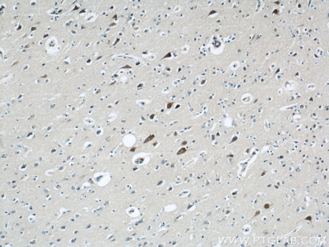 GRIN2B Antibody in Immunohistochemistry (Paraffin) (IHC (P))