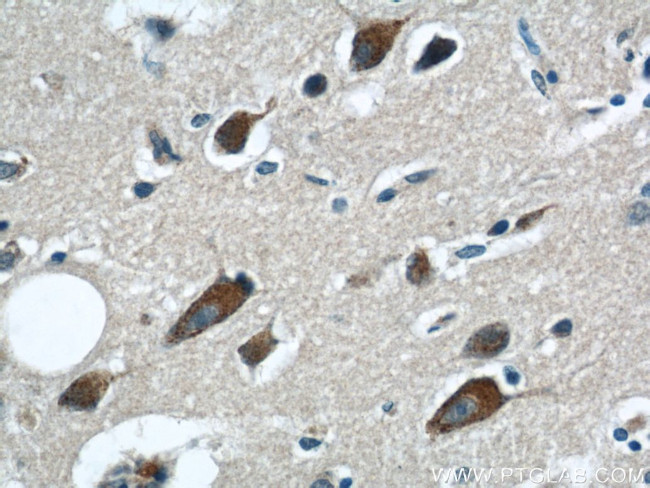 GRIN2B Antibody in Immunohistochemistry (Paraffin) (IHC (P))