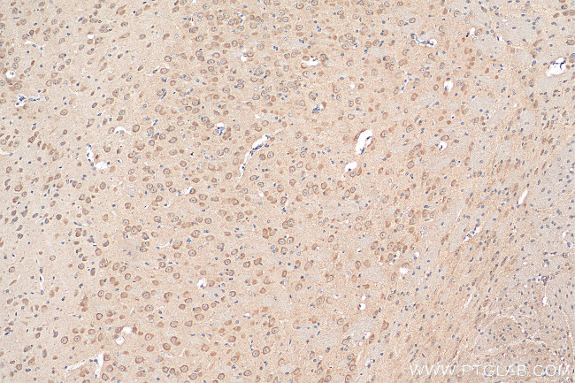 GRIN2B Antibody in Immunohistochemistry (Paraffin) (IHC (P))