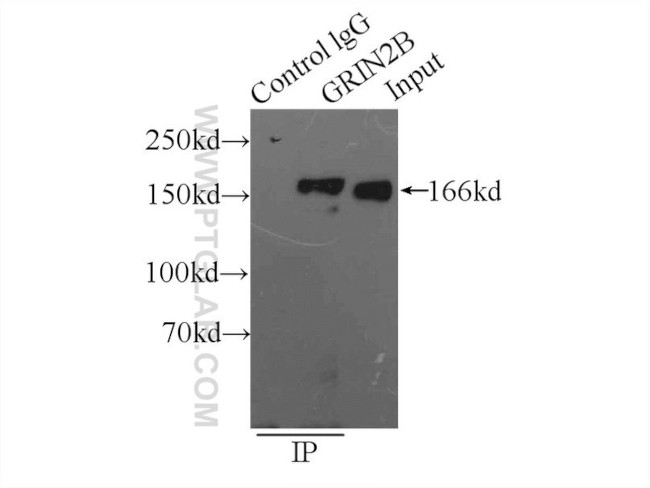 GRIN2B Antibody in Immunoprecipitation (IP)