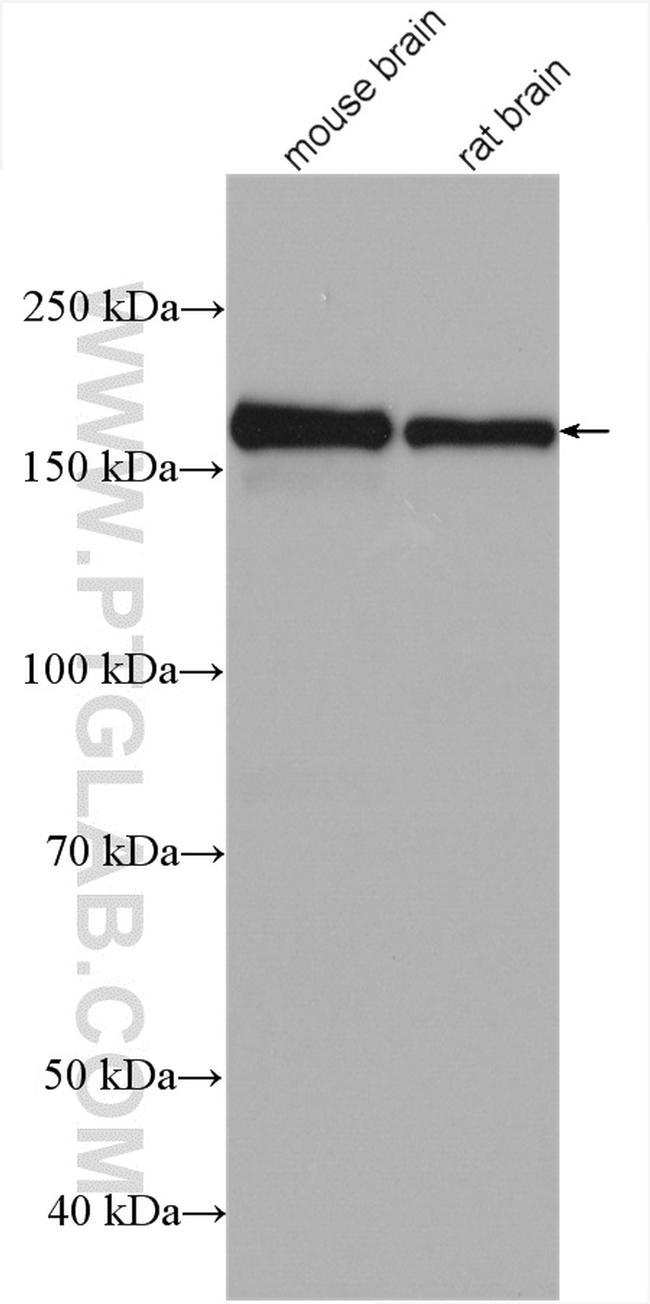 GRIN2B Antibody in Western Blot (WB)