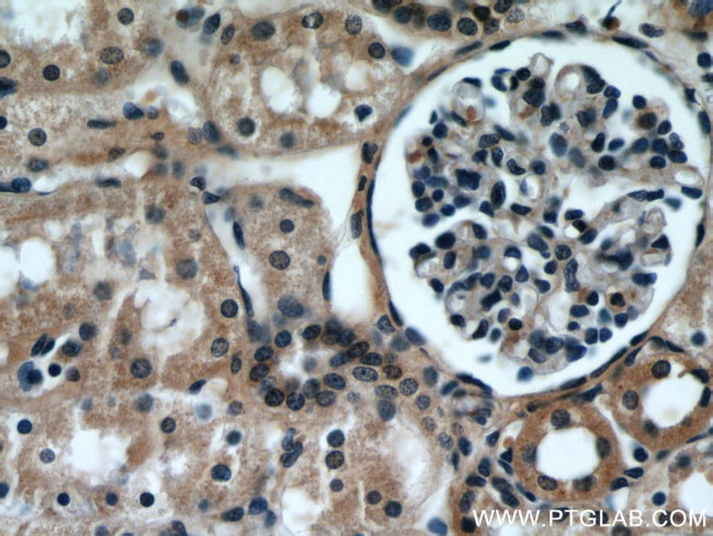 VMA21 Antibody in Immunohistochemistry (Paraffin) (IHC (P))