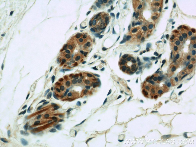 VMA21 Antibody in Immunohistochemistry (Paraffin) (IHC (P))