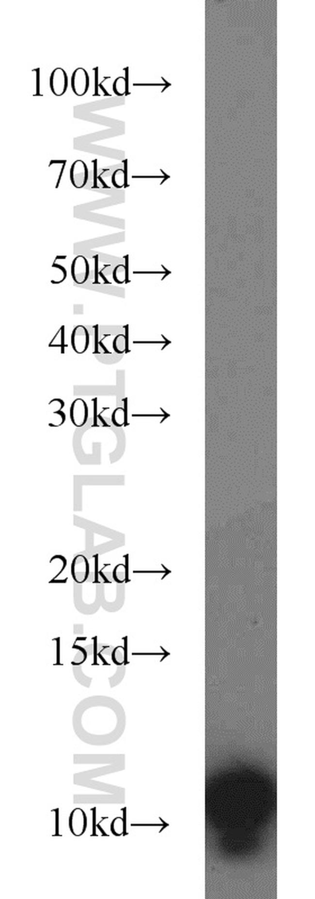 VMA21 Antibody in Western Blot (WB)