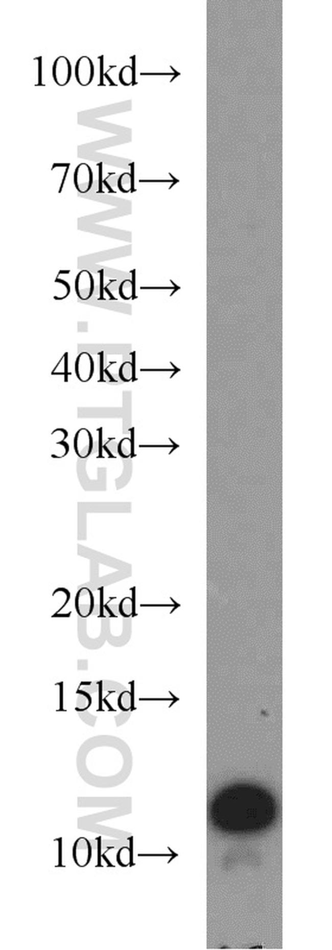 VMA21 Antibody in Western Blot (WB)