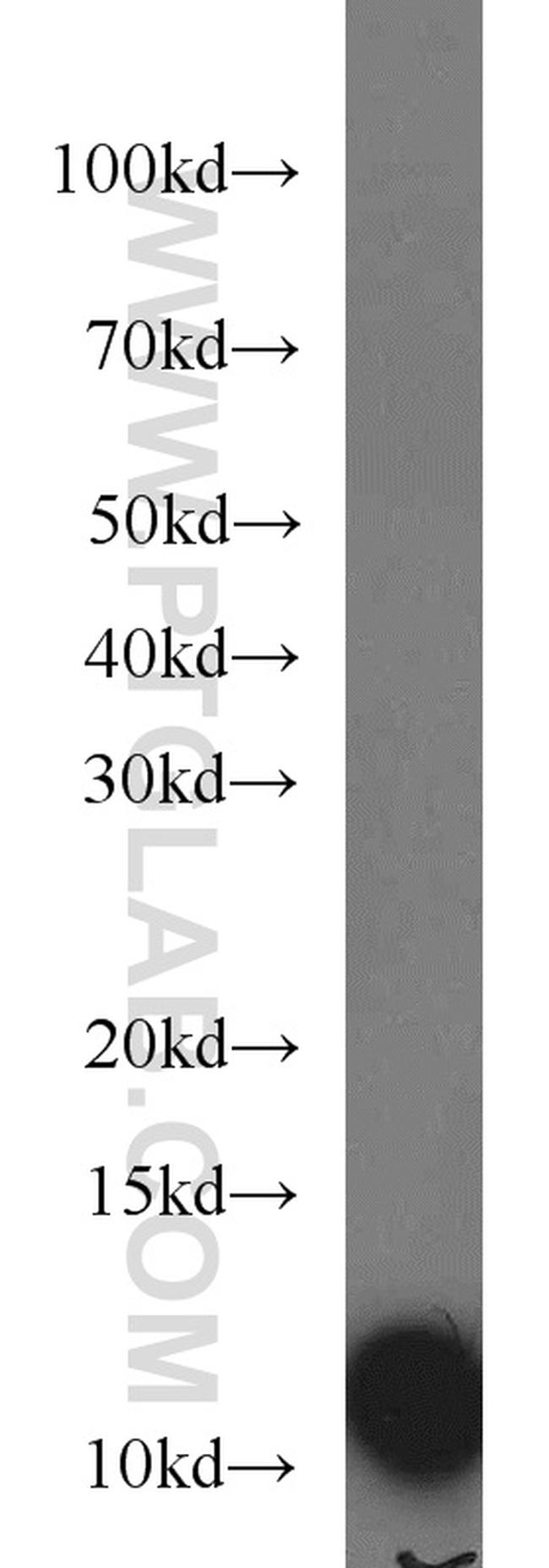 VMA21 Antibody in Western Blot (WB)