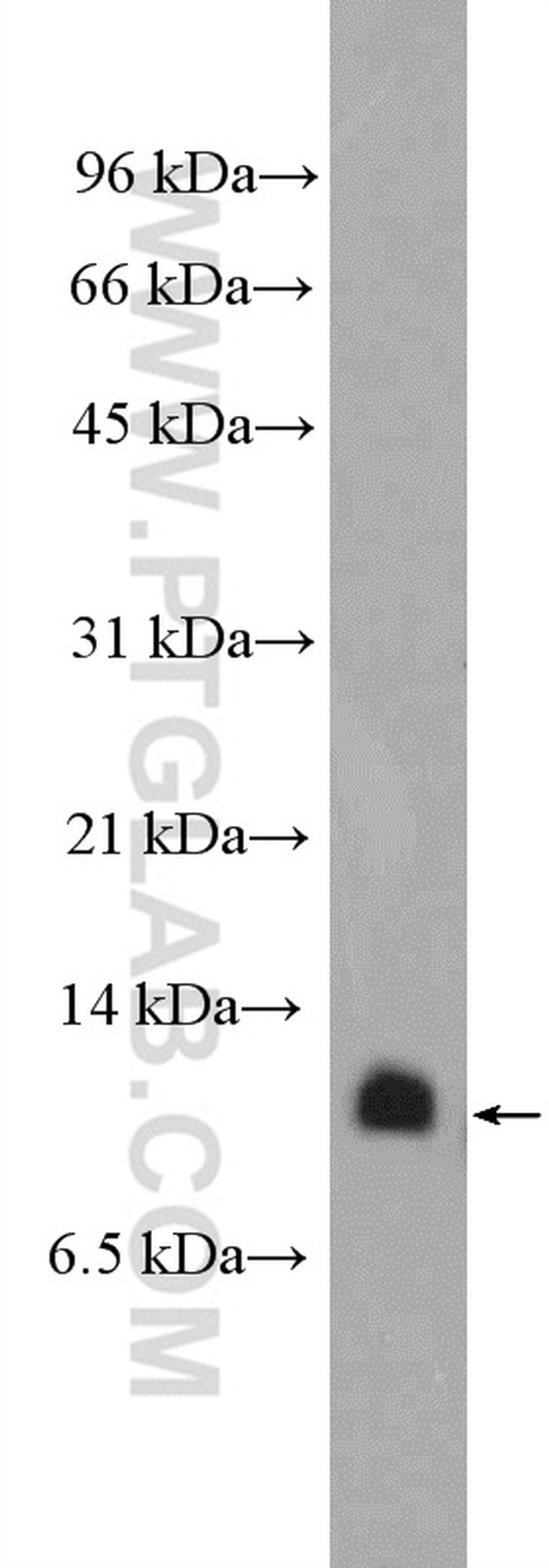 VMA21 Antibody in Western Blot (WB)