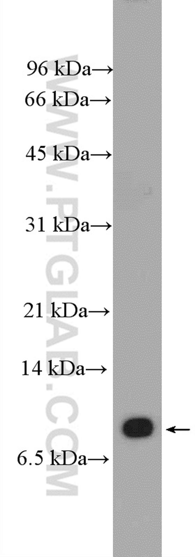 VMA21 Antibody in Western Blot (WB)