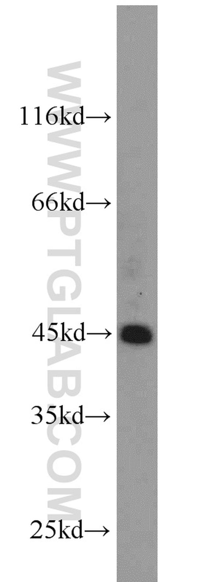 ZNF763 Antibody in Western Blot (WB)