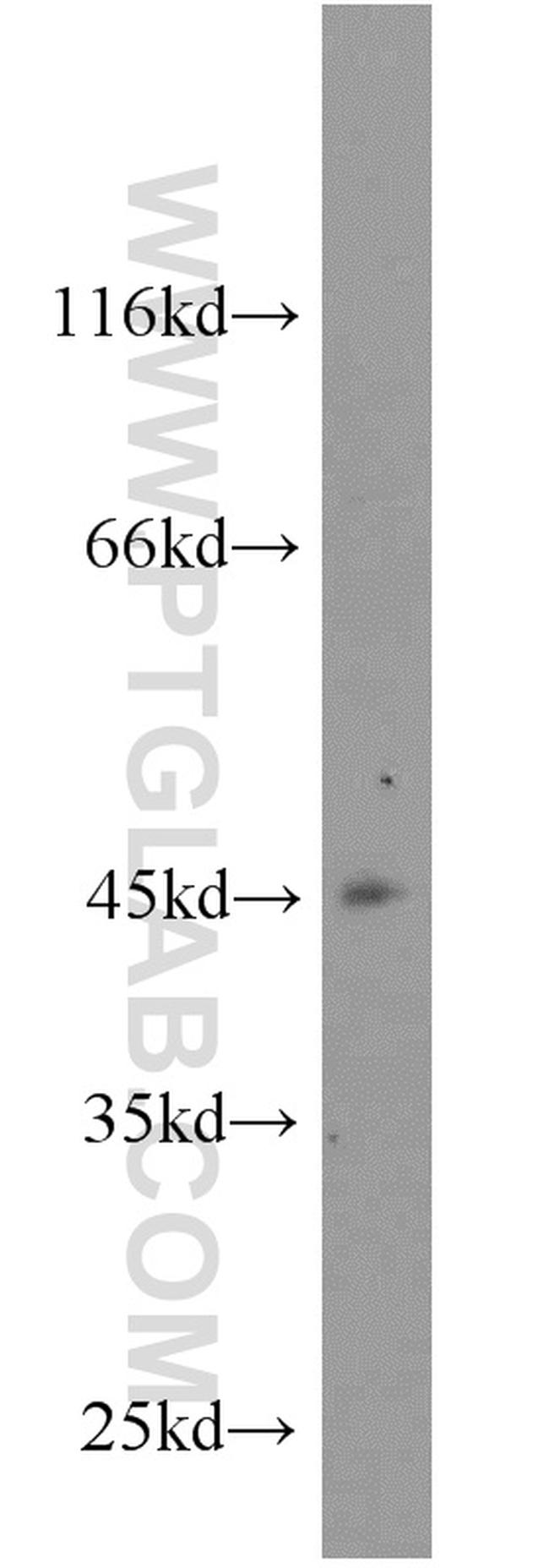ZNF763 Antibody in Western Blot (WB)