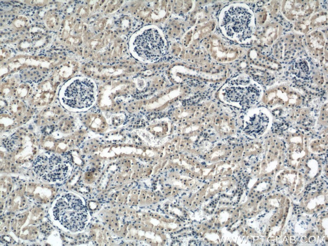 ACC1 Antibody in Immunohistochemistry (Paraffin) (IHC (P))