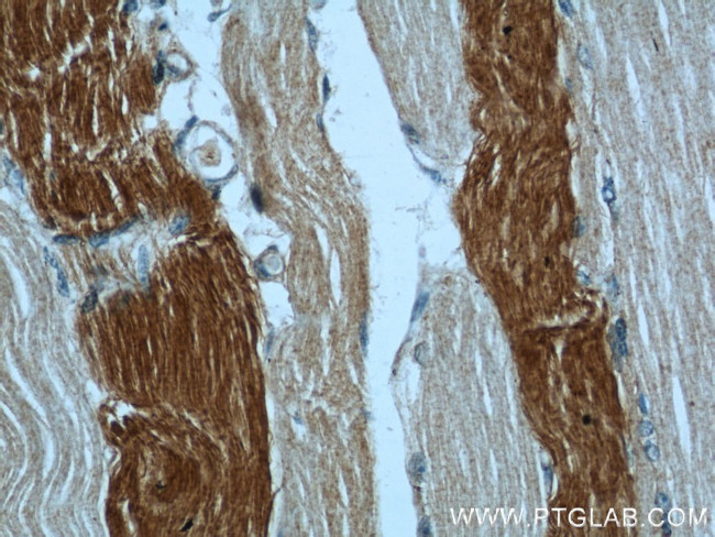 ACC1 Antibody in Immunohistochemistry (Paraffin) (IHC (P))