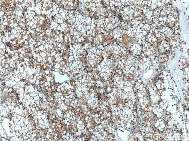 ACC1 Antibody in Immunohistochemistry (Paraffin) (IHC (P))