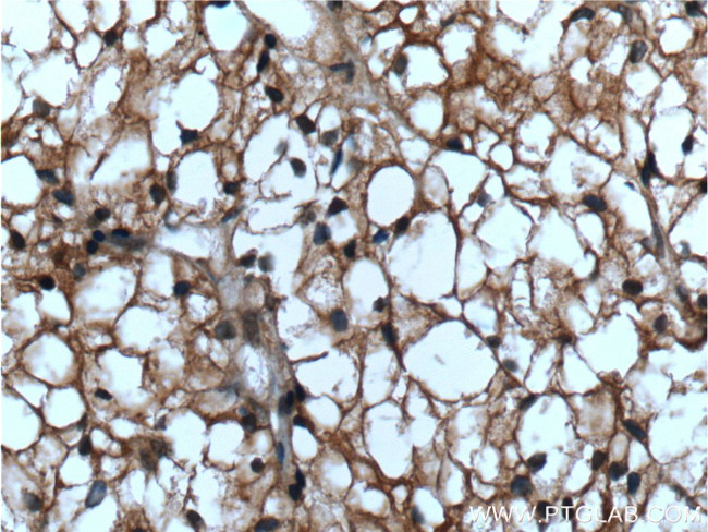 ACC1 Antibody in Immunohistochemistry (Paraffin) (IHC (P))