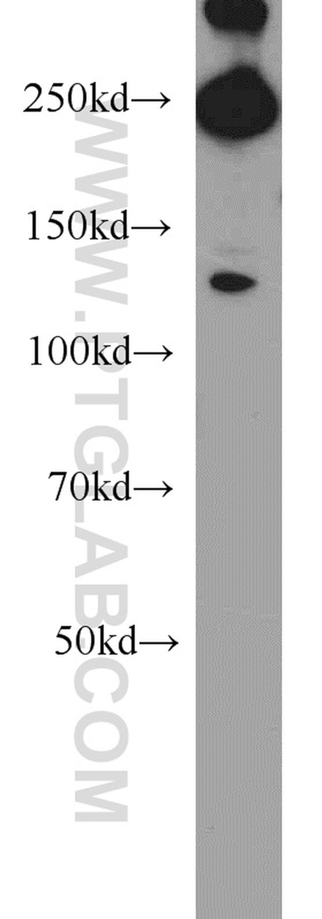 ACC1 Antibody in Western Blot (WB)