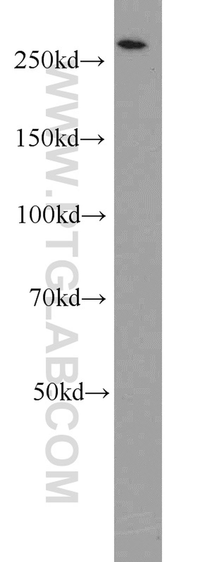 ACC1 Antibody in Western Blot (WB)