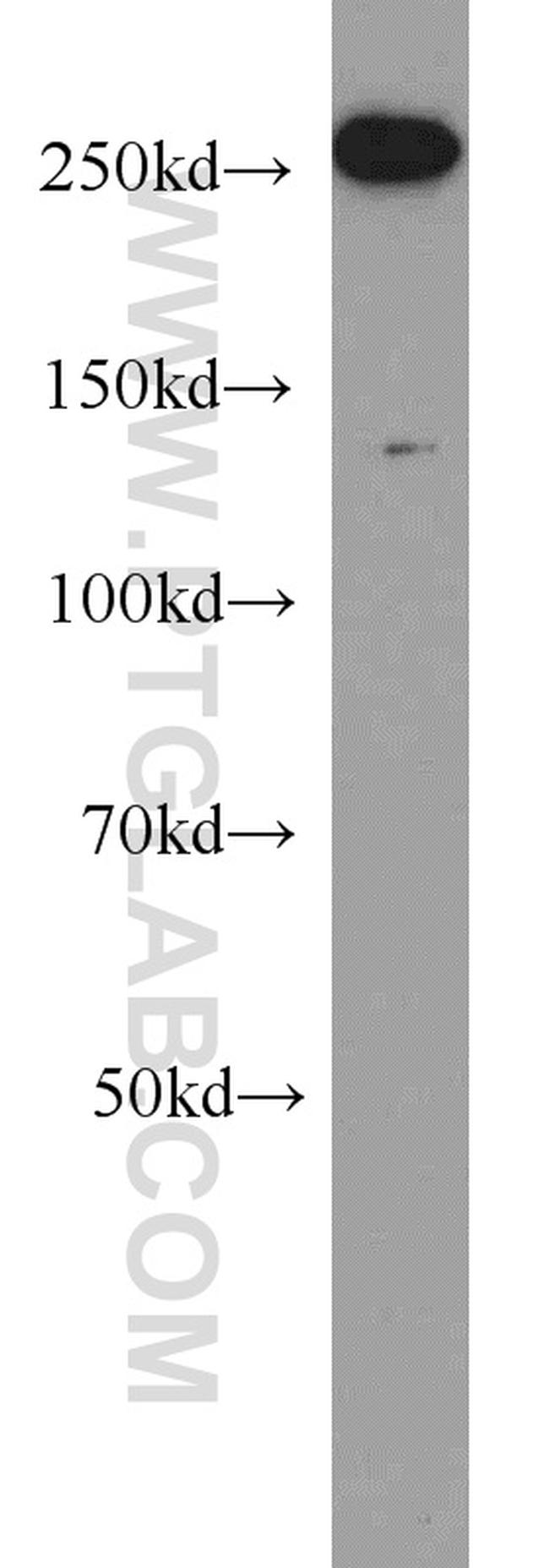 ACC1 Antibody in Western Blot (WB)