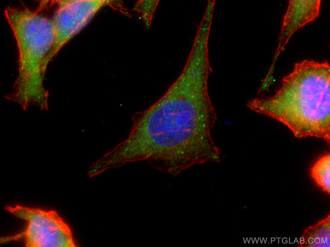 ACC1 Antibody in Immunocytochemistry (ICC/IF)