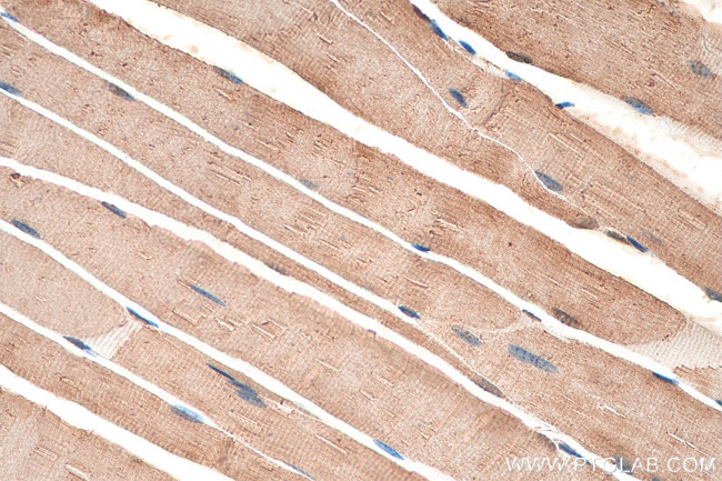 ACC1 Antibody in Immunohistochemistry (Paraffin) (IHC (P))