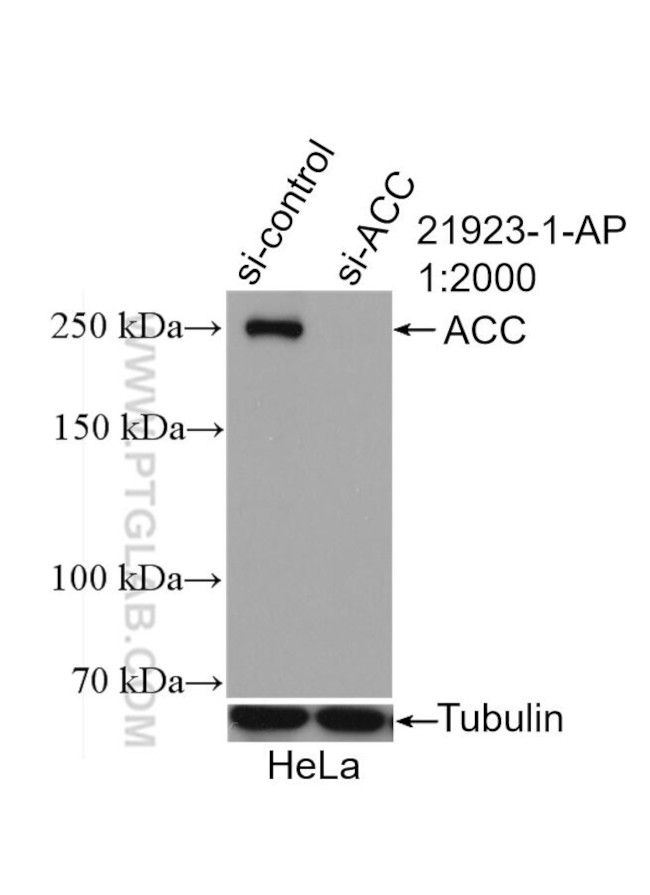 ACC1 Antibody in Western Blot (WB)