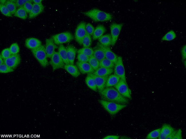 ACC1 Antibody in Immunocytochemistry (ICC/IF)