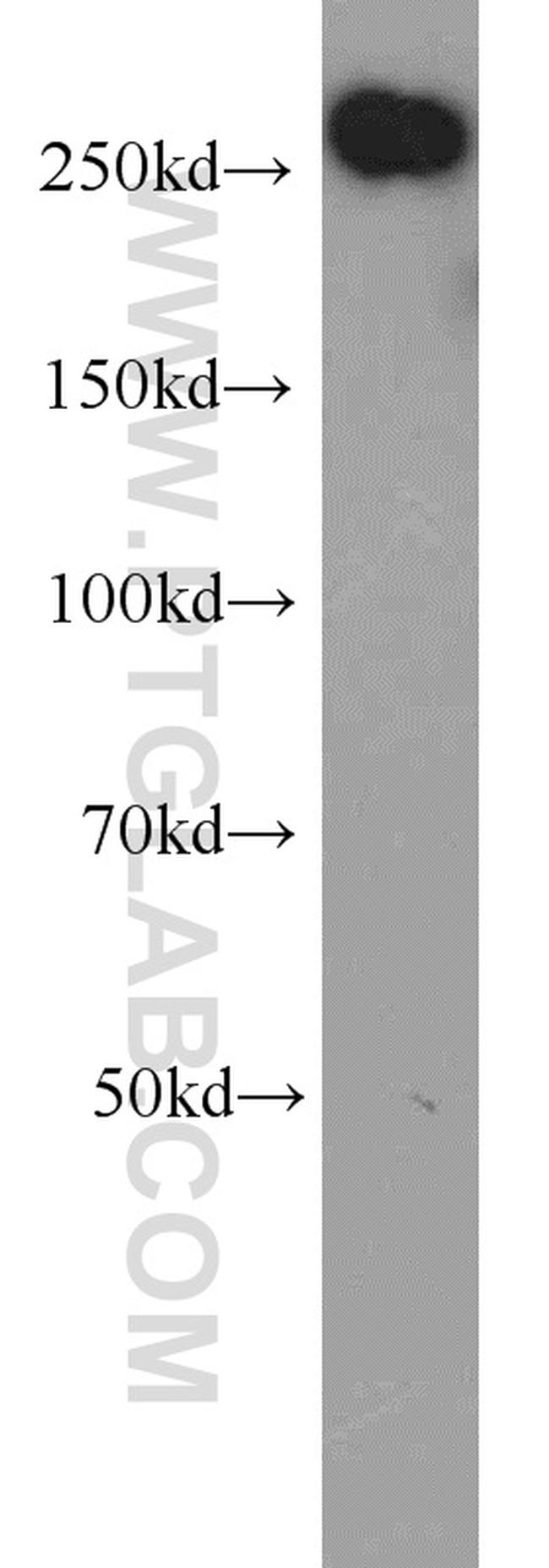 ACC1 Antibody in Western Blot (WB)