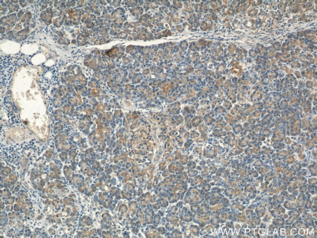 VAV2 Antibody in Immunohistochemistry (Paraffin) (IHC (P))