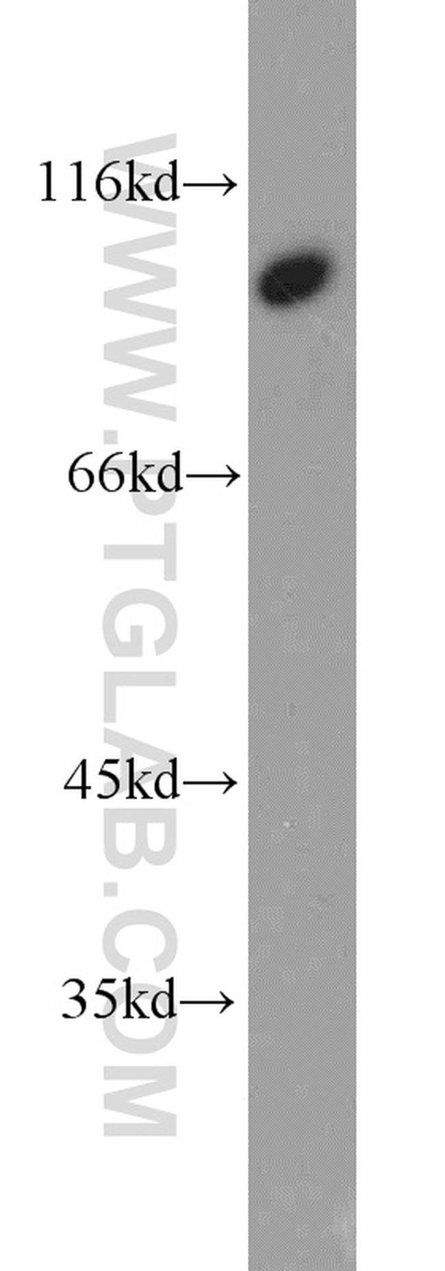 VAV2 Antibody in Western Blot (WB)