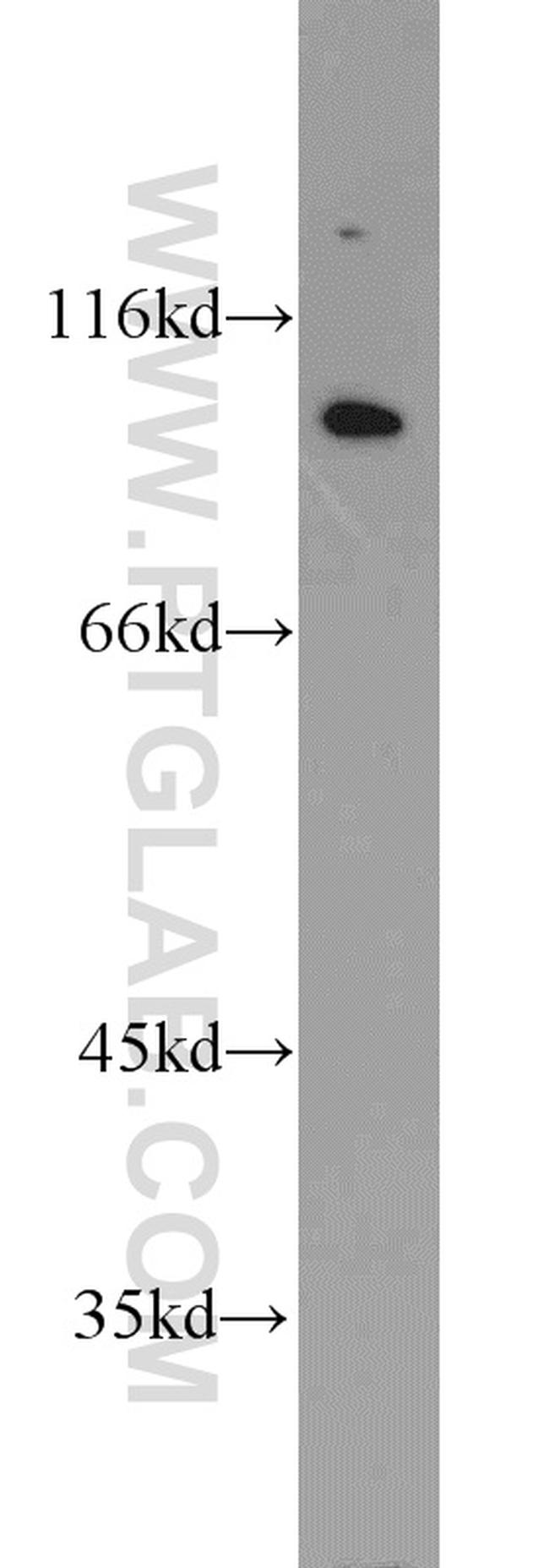 VAV2 Antibody in Western Blot (WB)