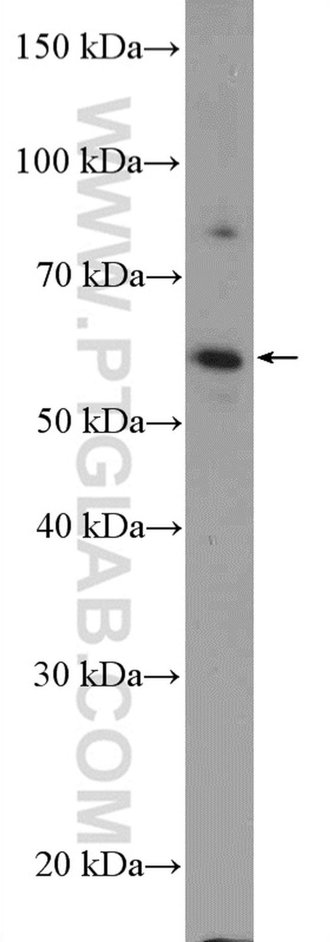 KIAA0895 Antibody in Western Blot (WB)