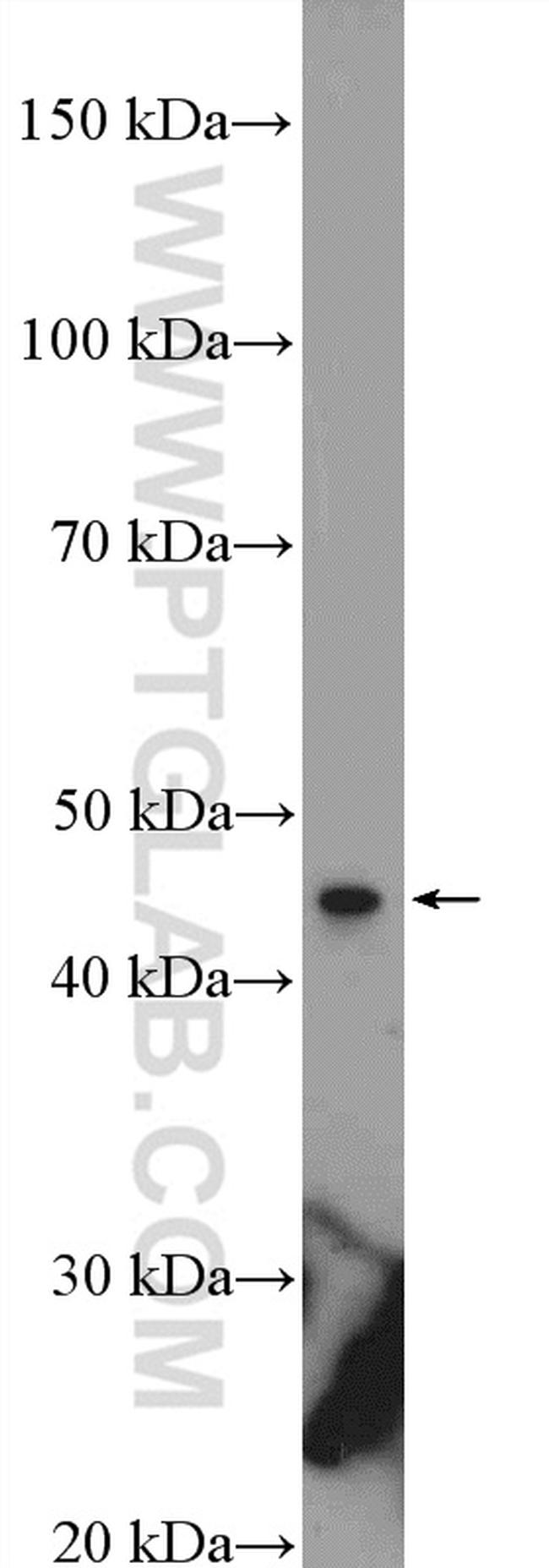 KIAA0895 Antibody in Western Blot (WB)