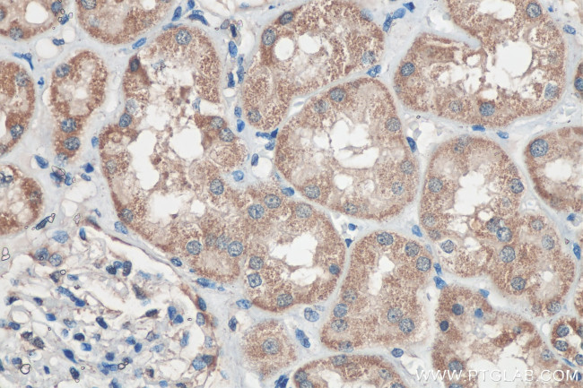 Sclerostin Antibody in Immunohistochemistry (Paraffin) (IHC (P))