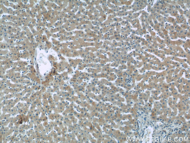 Sclerostin Antibody in Immunohistochemistry (Paraffin) (IHC (P))