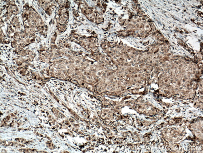 Sclerostin Antibody in Immunohistochemistry (Paraffin) (IHC (P))